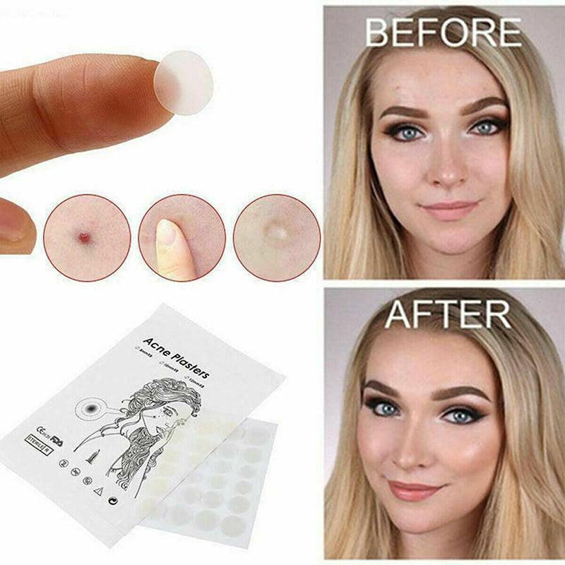36 Pcs Acne Pimple Plasters Patch Removal Blemish Control Skin Facial Care Spot