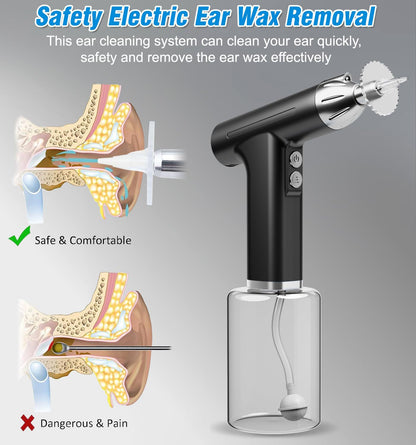 White Electric Earwax Irrigator Set - Gentle and effective earwax cleaner with collection basin and earplugs